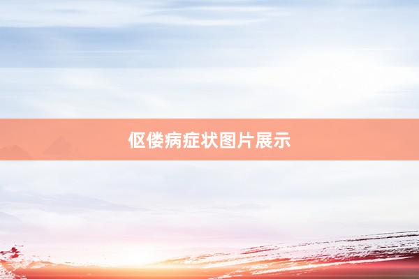 伛偻病症状图片展示