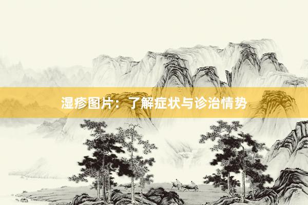 湿疹图片：了解症状与诊治情势